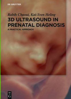 3D Ultrasound in Prenatal Diagnosis: A Practical Approach (Original PDF from Publisher)