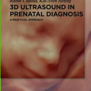 3D Ultrasound in Prenatal Diagnosis: A Practical Approach (Original PDF from Publisher)