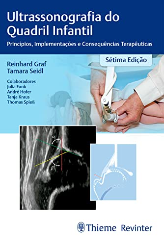 Ultrassonografia do quadril infantil: Princípios, implementação e consequências terapêuticas (Portuguese Edition) (EPUB)