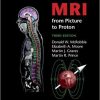 MRI from Picture to Proton, 3e (ORIGINAL PDF from Publisher)