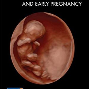 Ultrasound in Assisted Reproduction and Early Pregnancy (Original PDF from Publisher)