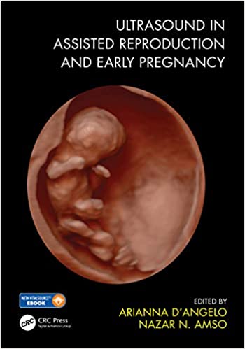 Ultrasound in Assisted Reproduction and Early Pregnancy (Original PDF from Publisher)