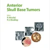 Anterior Skull Base Tumors (ISSN) (EPUB)