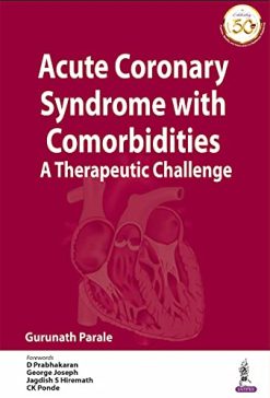 Acute Coronary Syndrome with Comorbidities: A Therapeutic Challenge (Original PDF from Publisher)