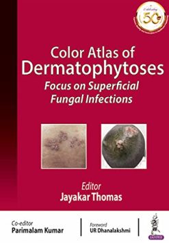 Color Atlas of Dermatophytoses: Focus on Superficial Fungal Infections (Original PDF from Publisher)