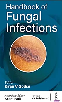Handbook of Fungal Infections (Original PDF from Publisher)