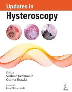 Updates in Hysteroscopy (Original PDF from Publisher)