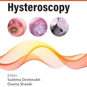 Updates in Hysteroscopy (Original PDF from Publisher)