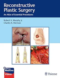 Reconstructive Plastic Surgery: An Atlas of Essential Procedures (EPUB)