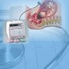 Actocardiogram: Analysis of Fetal Motion and Heart Rate (Original PDF from Publisher)