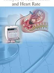 Actocardiogram: Analysis of Fetal Motion and Heart Rate (Original PDF from Publisher)