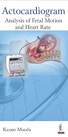 Actocardiogram: Analysis of Fetal Motion and Heart Rate (Original PDF from Publisher)