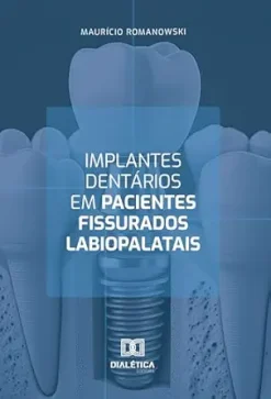 Implantes dentários em pacientes fissurados labiopalatais (Portuguese Edition) (EPUB)