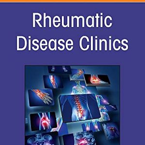 Pediatric Rheumatology Comes of Age: Part II, An Issue of Rheumatic Disease Clinics of North America (Volume 48-1) (The Clinics: Internal Medicine, Volume 48-1) (Original PDF from Publisher)