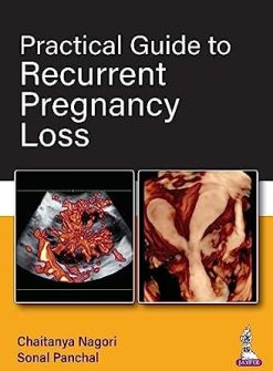 Practical Guide to Recurrent Pregnancy Loss (Original PDF from Publisher)