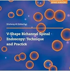 V-shape Bichannel Spinal Endoscopy: Technique and Practice (Original PDF from Publisher)