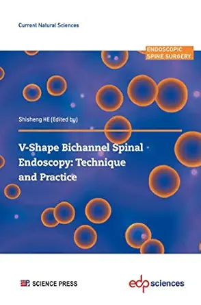 V-shape Bichannel Spinal Endoscopy: Technique and Practice (Original PDF from Publisher)