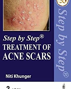 Step by Step Treatment of Acne Scars, 2nd Edition (Original PDF from Publisher)