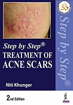 Step by Step Treatment of Acne Scars, 2nd Edition (Original PDF from Publisher)