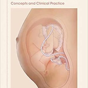 Anesthesia for Maternal-Fetal Surgery: Concepts and Clinical Practice New Edition (Original PDF From Publisher)