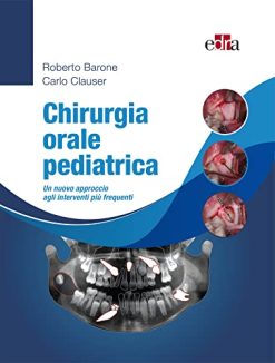 Chirurgia orale pediatrica: Un nuovo approccio agli interventi più frequenti (Italian Edition) (EPUB)
