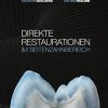 Direkte Restaurationen im Seitenzahnbereich (German Edition) (EPUB)