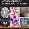Neurological Consequences of Nutritional Disorders (Original PDF from Publisher)