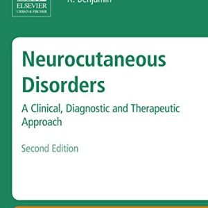 Neurocutaneous Disorders: A Clinical, Diagnostic and Therapeutic Approach, 2nd Edition (Original PDF from Publisher)