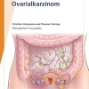 Fast Facts: Ovarialkarzinom (German Edition) (EPUB)
