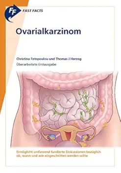 Fast Facts: Ovarialkarzinom (German Edition) (EPUB)