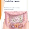 Fast Facts: Ovarialkarzinom (German Edition) (Original PDF from Publisher)