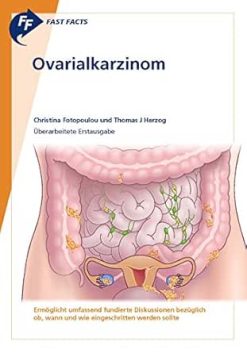 Fast Facts: Ovarialkarzinom (German Edition) (Original PDF from Publisher)