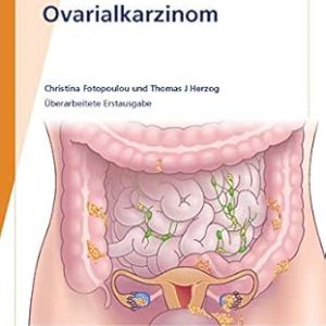 Fast Facts: Ovarialkarzinom (German Edition) (Original PDF from Publisher)