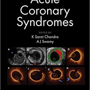 Acute Coronary Syndromes (Original PDF from Publisher)