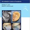 O Menisco: Da Avaliação e Lesão ao Transplante, 1st edition (Original PDF from Publisher)