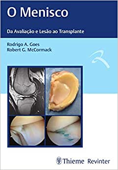 O Menisco: Da Avaliação e Lesão ao Transplante, 1st edition (Original PDF from Publisher)
