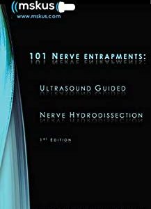 101 Nerve Entrapments: Ultrasound Guided Nerve Hydrodissection (Original PDF from Publisher)