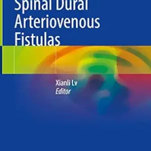 Intracranial and Spinal Dural Arteriovenous Fistulas (EPUB)