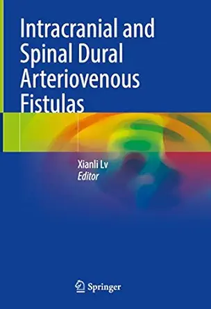 Intracranial and Spinal Dural Arteriovenous Fistulas (Original PDF from Publisher)