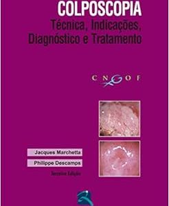 Colposcopia: Técnica, Indicações, Diagnóstico e Tratamento, 3rd Edition (Original PDF from Publisher)