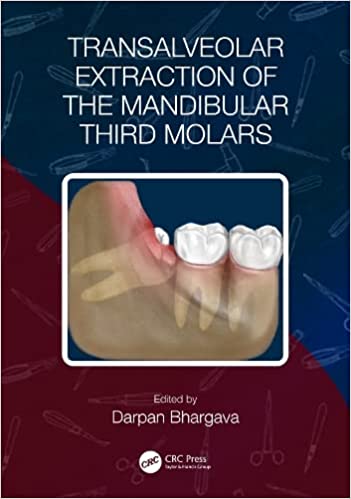 Transalveolar Extraction of the Mandibular Third Molars (Original PDF from Publisher)
