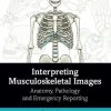 Interpreting Musculoskeletal Images: Anatomy, Pathology and Emergency Reporting (Original PDF from Publisher)