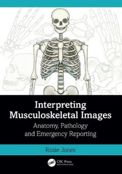 Interpreting Musculoskeletal Images: Anatomy, Pathology and Emergency Reporting (Original PDF from Publisher)