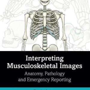 Interpreting Musculoskeletal Images: Anatomy, Pathology and Emergency Reporting (Original PDF from Publisher)