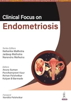 Clinical Focus on Endometriosis (Original PDF from Publisher)