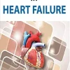 Algorithms in Heart Failure (Original PDF from Publisher)