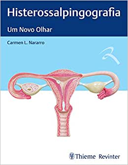 Histerossalpingografia: Um Novo Olhar (Original PDF from Publisher)