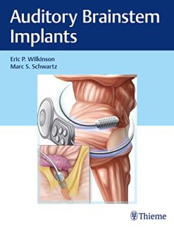 Auditory Brainstem Implants (Original PDF from Publisher)