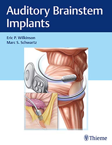 Auditory Brainstem Implants (Original PDF from Publisher)