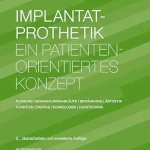 Implantatprothetik: Ein patientenorientiertes Konzept: Planung | Behandlungsabläufe | Bewährung | Ästhetik | Funktion | Digitale Technologien | Zahntechnik, 2nd Edition (German Edition) (EPUB)